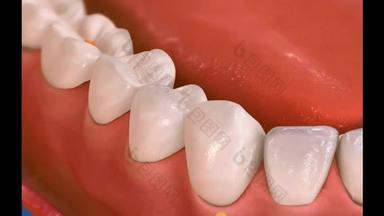 牙科3D影像-根治11